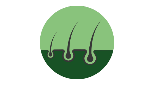 hairloss_1