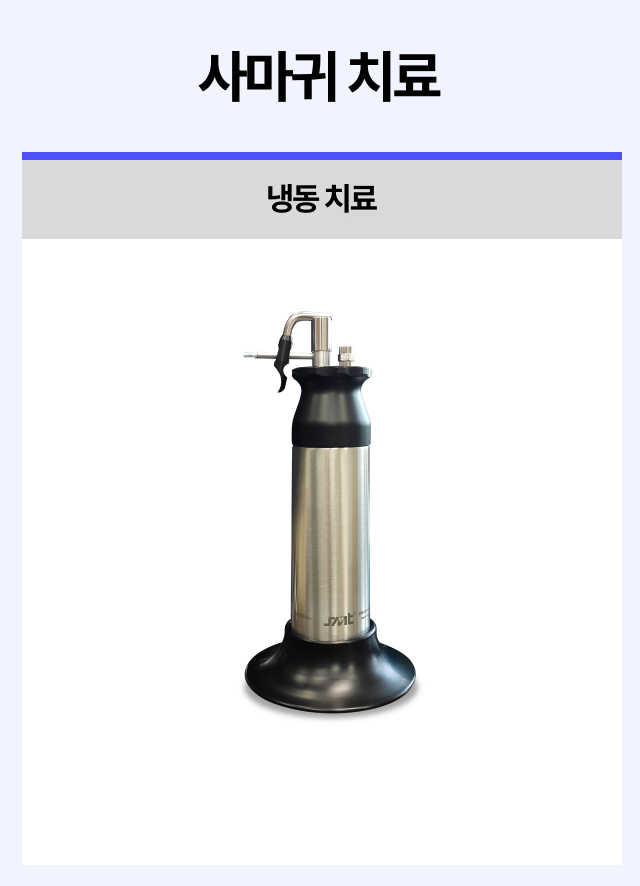 사마귀치료
