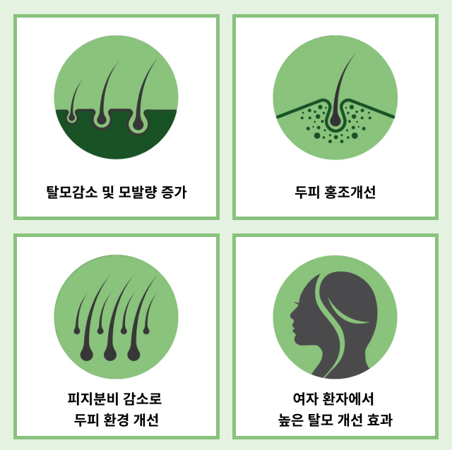 탈모_2